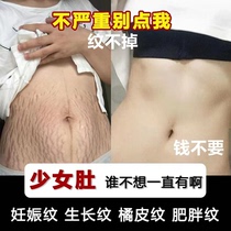 去妊娠纹修复霜橄榄油孕妇产后修护淡化消除男女士肥胖生长纹紧致