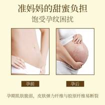 美容院专用按摩精油妊娠纹孕妇产后肥胖纹修复淡化生长纹橄榄油